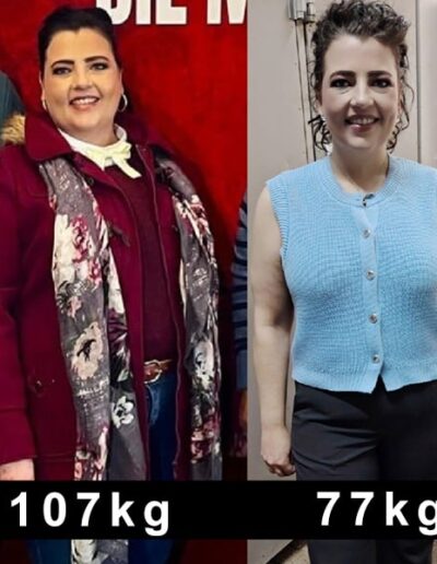 The Exodus Experience Before After 26